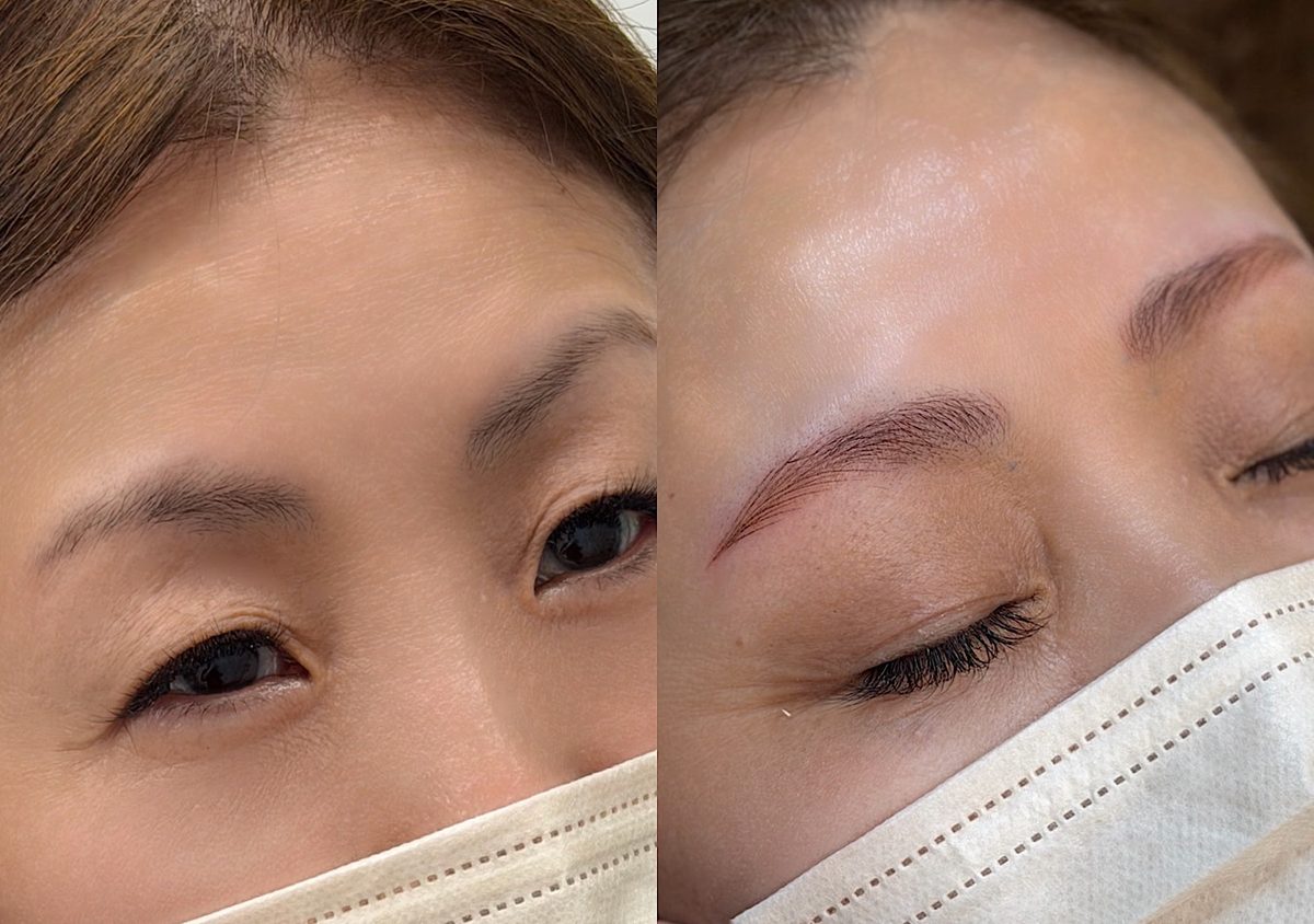 眉毛タトゥー before after 症例1