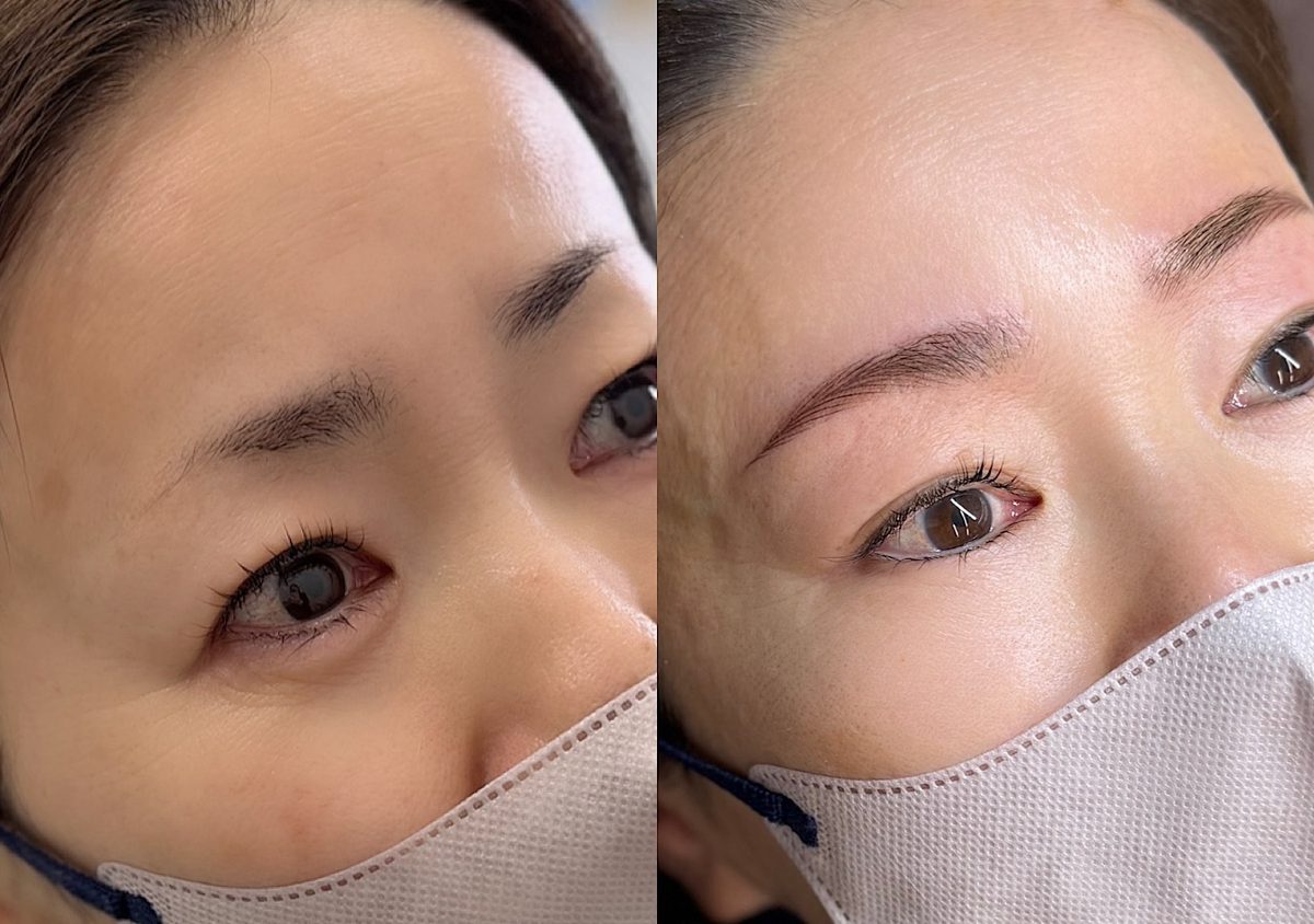 眉毛タトゥー before after 症例2