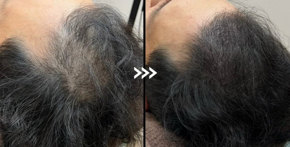 Scalp Inkとは?